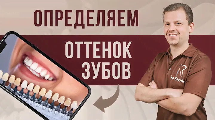 Определяем ОТТЕНОК ЗУБОВ. Секреты ИДЕАЛЬНОЙ УЛЫБКИ.