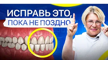 Твои зубы смыкаются неправильно! Как исправить окклюзию зубов?
